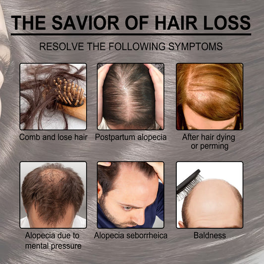 Anti Hair Loss Serum
