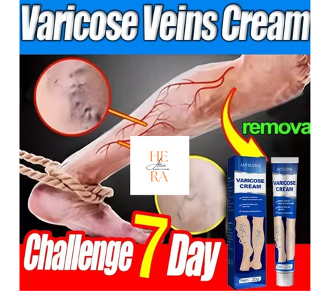 Unguent pentru vene varicoase elimină vasculita flebită 